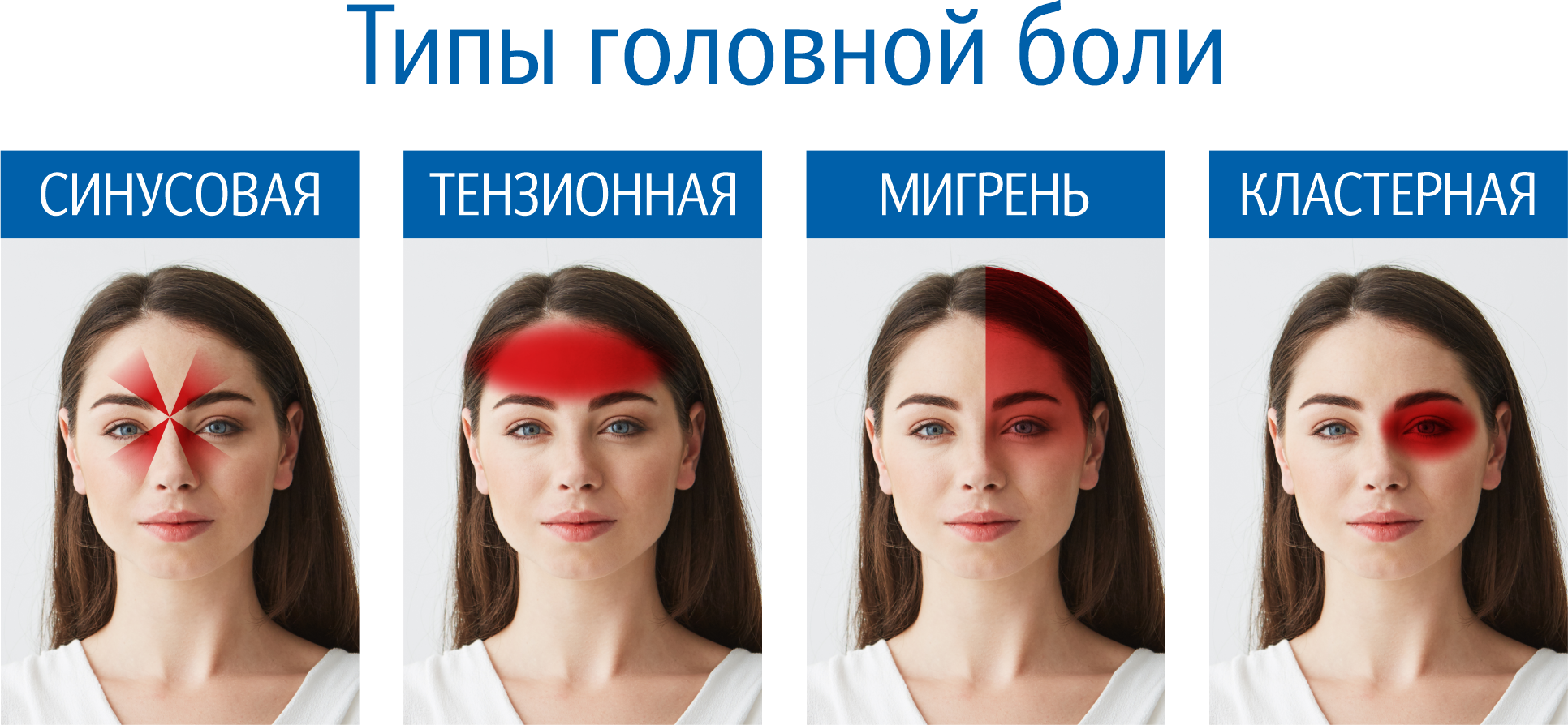 Типы головной боли ГОЛОВНАЯ БОЛЬ ВИДЫ.png