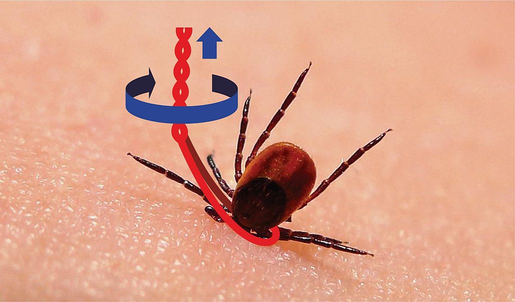 Как вытащить клеща с помощью нитки Инструкция как вытащить клеща.jpg