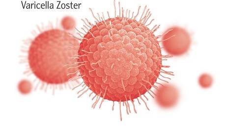 ветрянка ветрянка