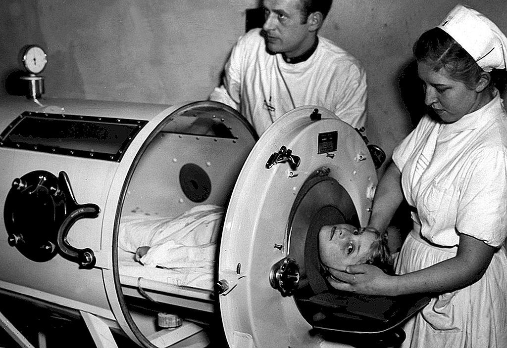 Железные легкие.jpg