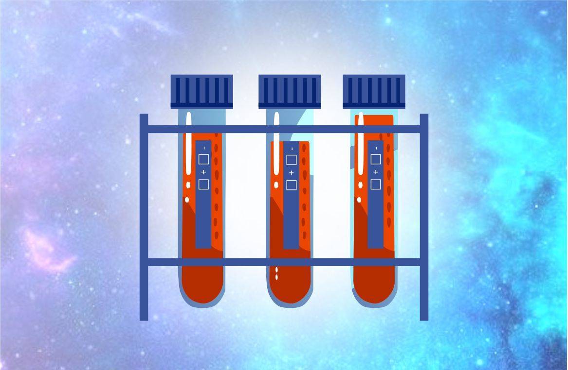Анализ крови на антитела класса Ig G к двуспиральной (нативной) ДНК