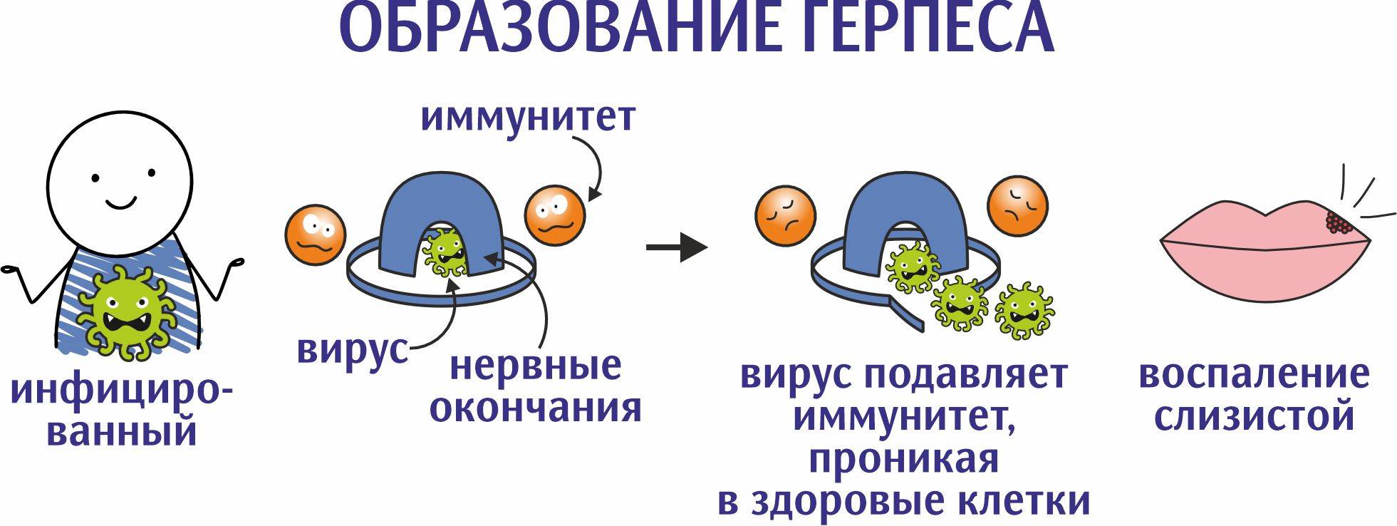 Вирус простого герпеса: так ли он прост, как все привыкли думать? | Блог |  Аско-Мед в Новосибирске и Барнауле